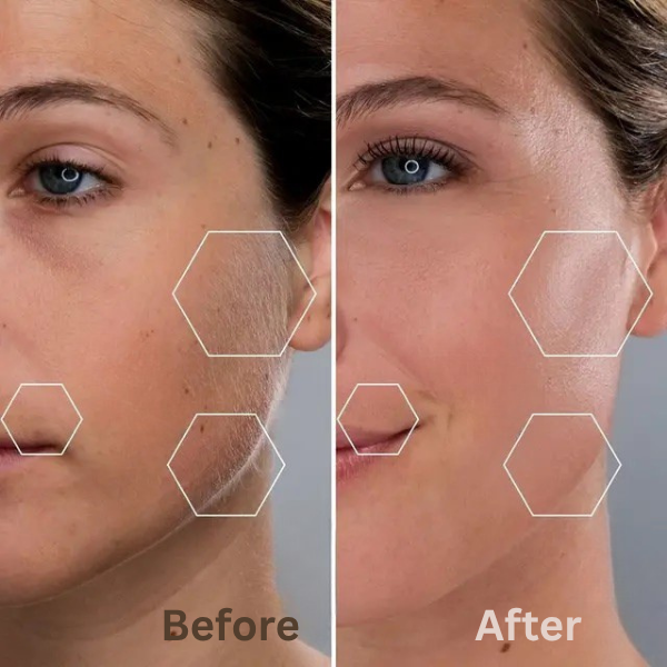 Silca - Finally, End Your Menopausal Mustache!