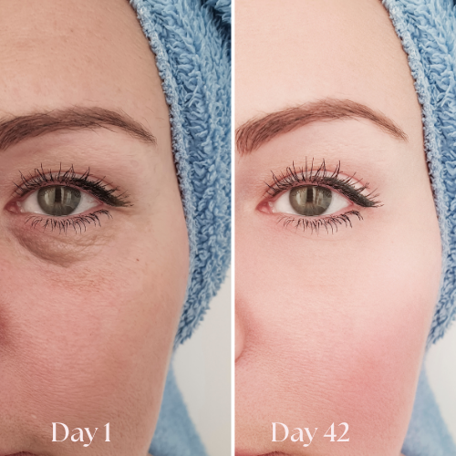 FreshGaze - Make tired eyes look years younger in 3 minutes