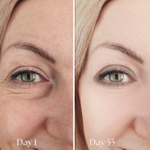 FreshGaze - Make tired eyes look years younger in 3 minutes