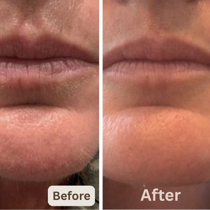 Silca - Finally, End Your Menopausal Mustache!