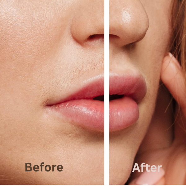 Silca - Finally, End Your Menopausal Mustache!