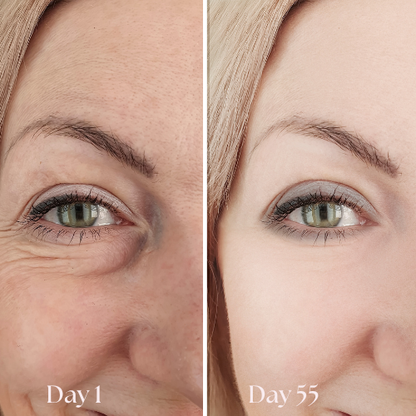 FreshGaze - Make tired eyes look years younger  in 3 minutes