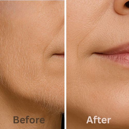 Silca - Finally, End Your Menopausal Mustache!