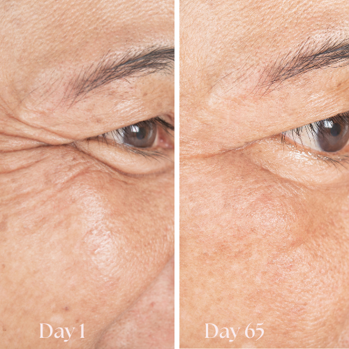 FreshGaze™ - Make tired eyes look years younger  in 3 minutes