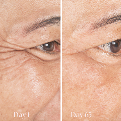 FreshGaze™ - Make tired eyes look years younger  in 3 minutes